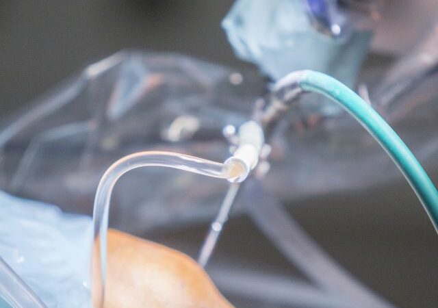 What is Arthroscopy? A Minimally Invasive Option for Knee Pain Relief